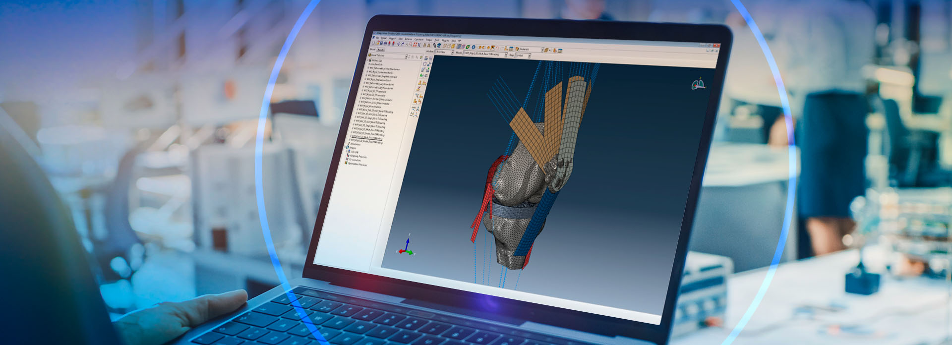 Abaqus Knee Simulator > 다쏘시스템